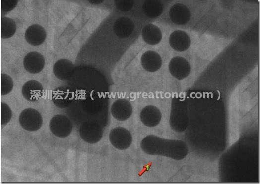 BGA因?yàn)楹笁|變小，造成錫膏過(guò)多而最終形成焊接短路的結(jié)果。